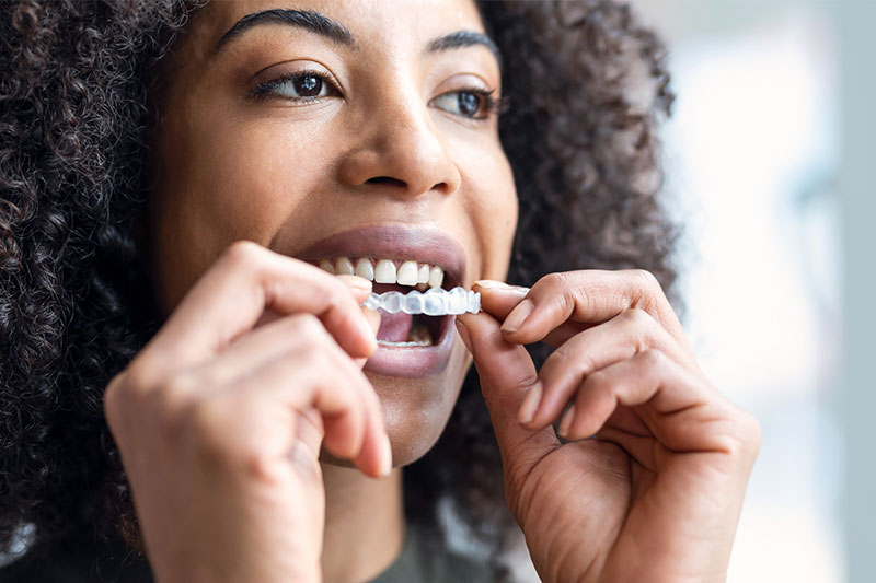 Invisalign Clear Aligner Therapy in Live Oak